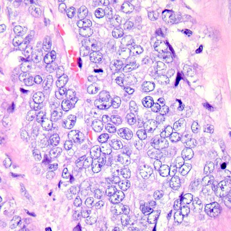 Multi-Cancer Detection Model